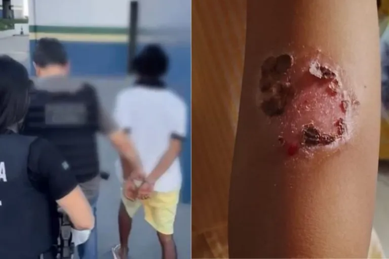 Pai é preso na Zona Norte por torturar filhos com utensílios de metal aquecidos