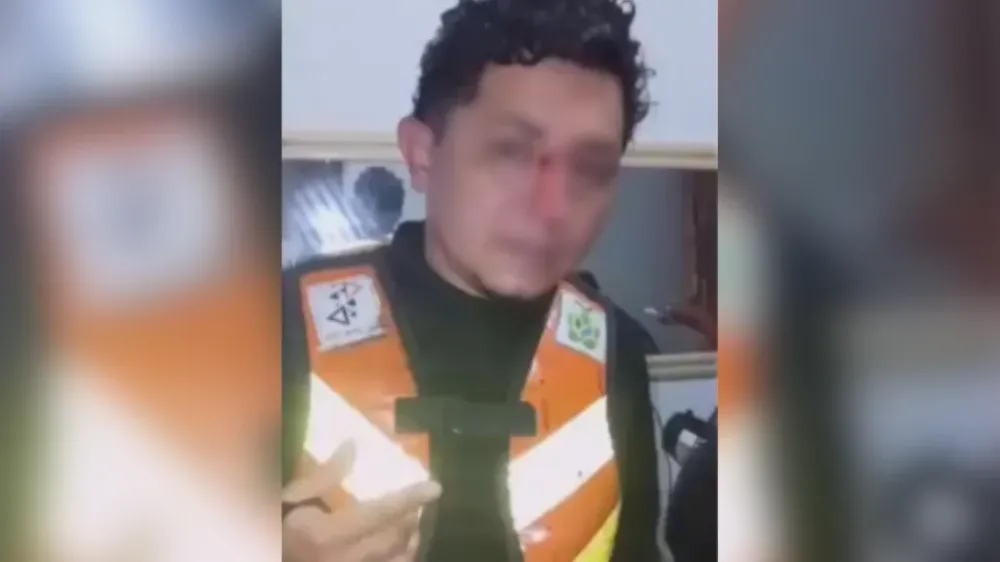 Mototaxista sofre corte profundo no rosto após ser atingido por linha de papagaio em Tefé