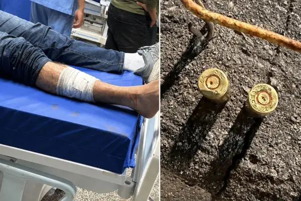Capitao da PMAM e baleado de raspao durante evento politico em Manaus
