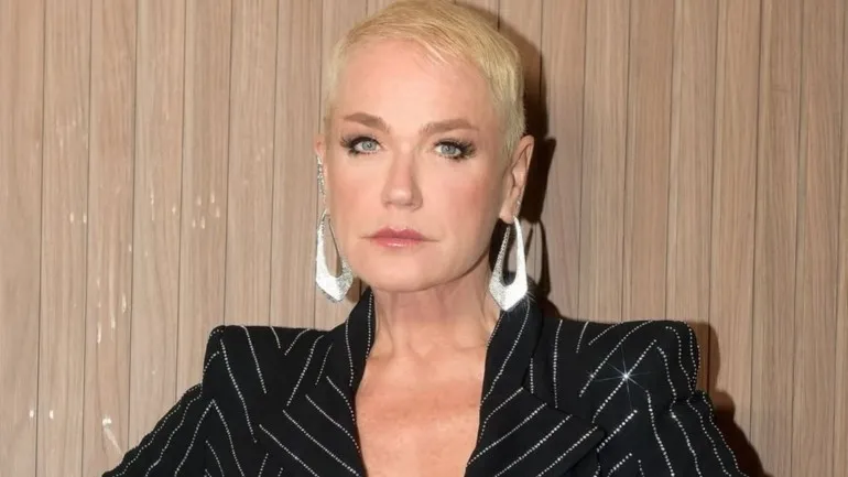 Xuxa Meneghel Passa por Cirurgia