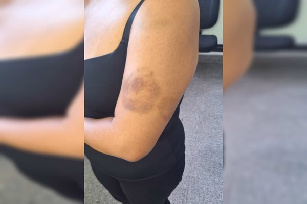 Homem ataca esposa e provoca destruição em cena de violência doméstica