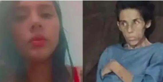 Justiça Investiga Morte de Manauara em Florianópolis Sob Suspeita de Maus-Tratos