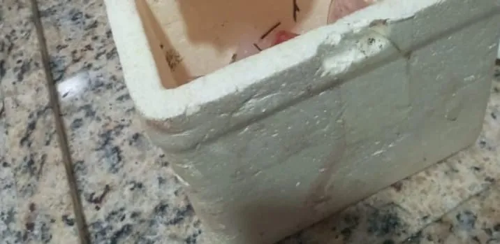 Homem tem a mão decepada e nariz perfurado durante briga a terçadadas no interior do Amazonas