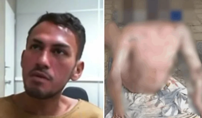 “Homem Ateia Fogo em Colega de Quarto em Tefé e Relata Detalhes de Prisão com Frieza Chocante”