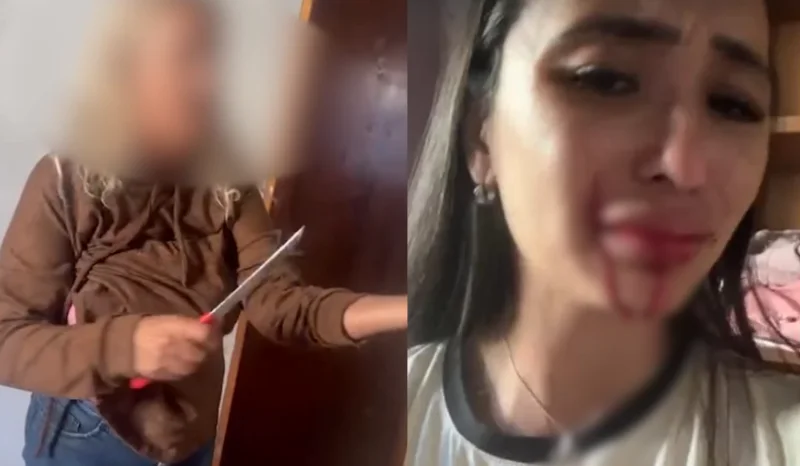 Ex-dançarina do Faustão é agredida pela mãe com facada no rosto após discussão familiar